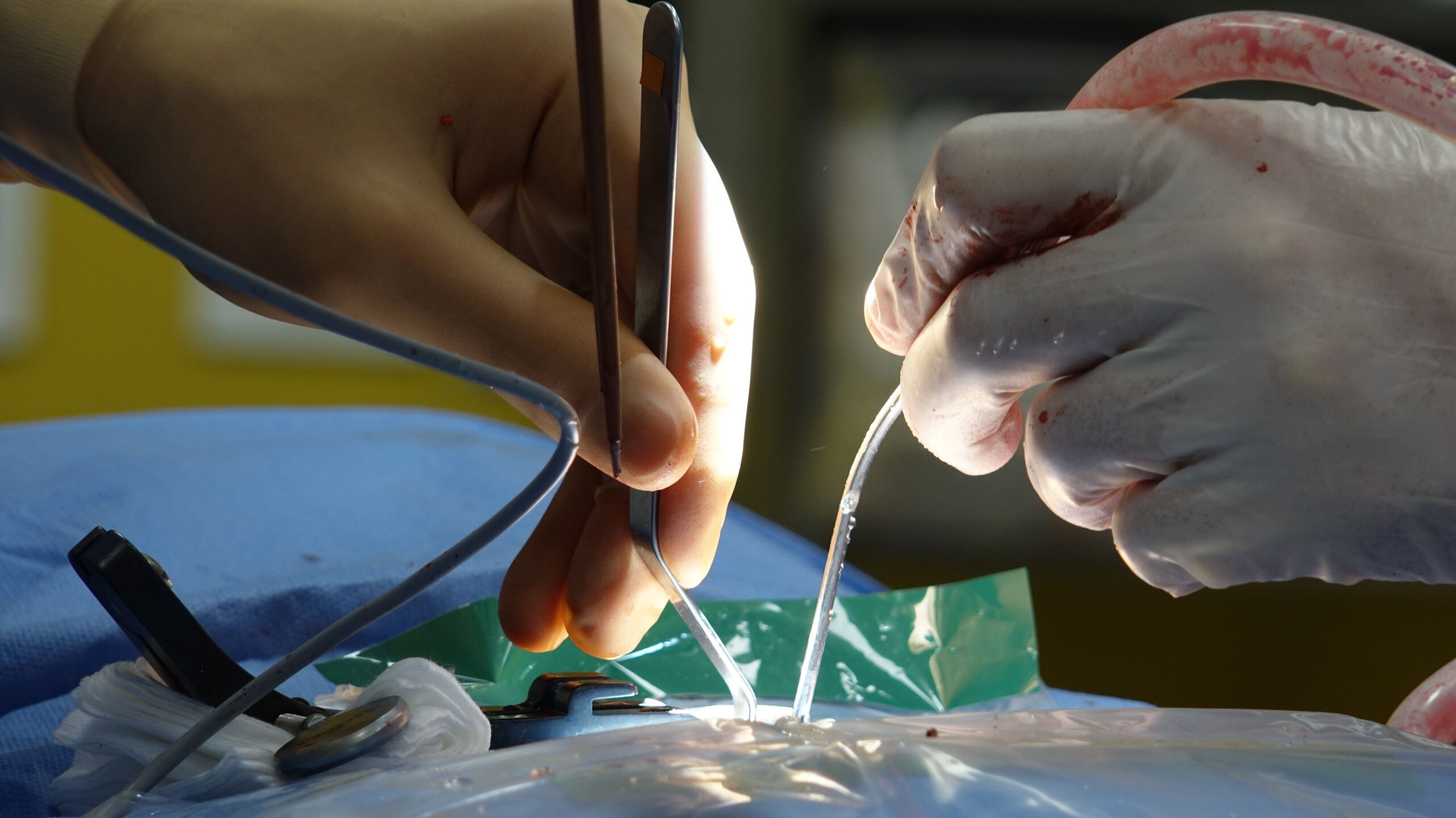 transplantacja